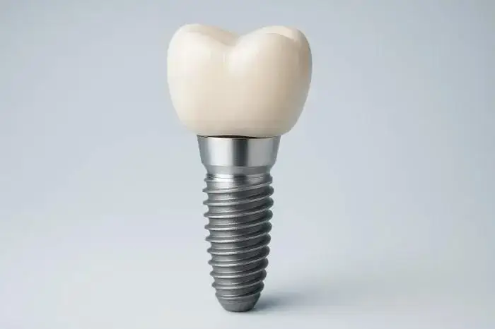 Single Dental Implants